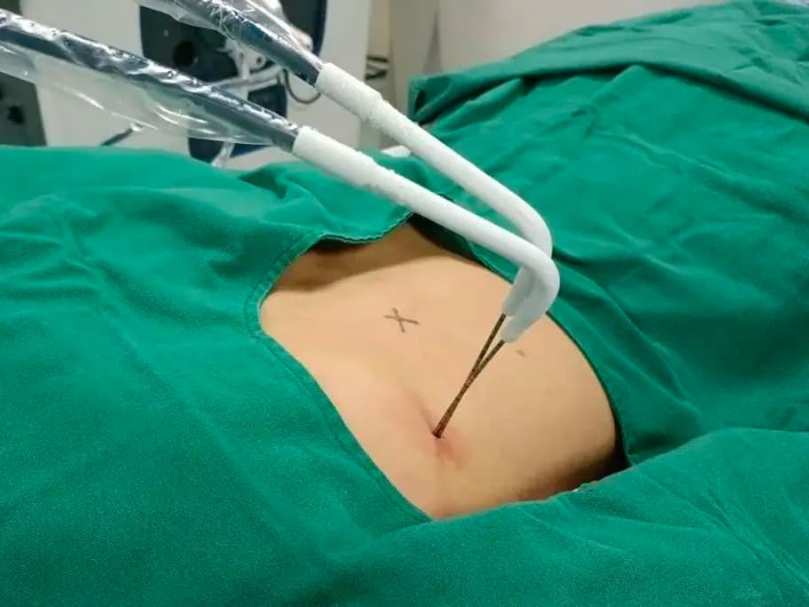 Implantasi Partikel